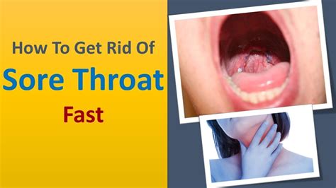 how to get rid of sore throat fast top 5 tricks to remove sore throat youtube
