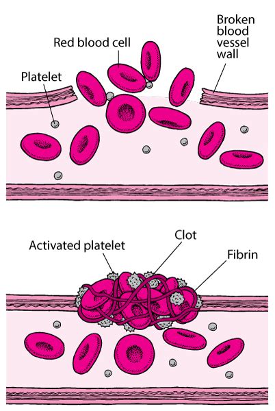 How Blood Clots Blood Disorders Msd Manual Consumer Version