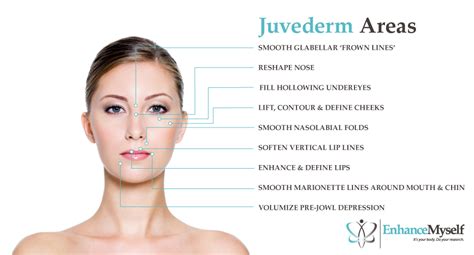 Juvederm Injections Under Eyes Lips Etc Cost Results