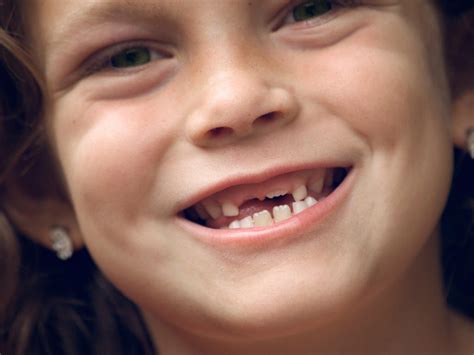 But it is possible for kids to lose a baby tooth before the permanent tooth is ready to erupt, especially because of an accident or dental disease. My child lost a baby tooth a year ago, and her permanent ...
