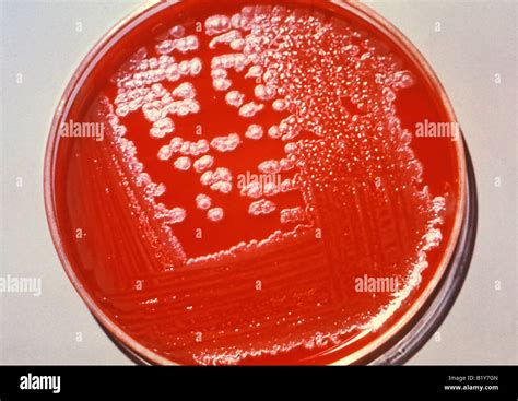Blood Agar Culture Plate Growing Bacillus Anthracis Anthrax Stock