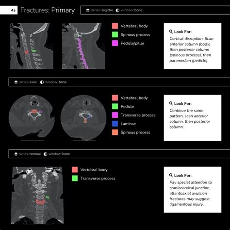 Differential Diagnosis Of Infographic Ct Cervical Spine Interpretation