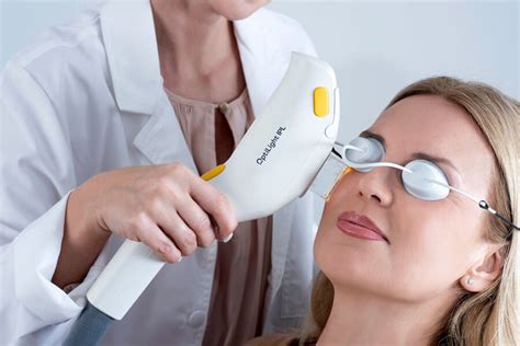 Intense Pulsed Light Therapy For Dry Eye Silicon Valley Eye Physicians Effective Dry Eye