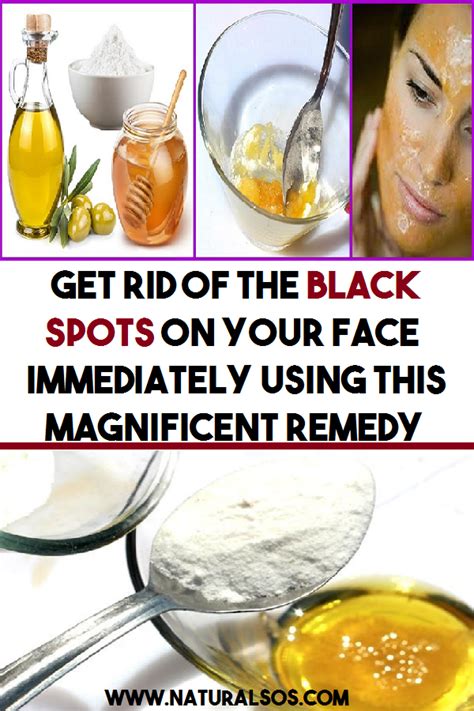 get rid of the black spots on your face immediately using this magnificent remedy beauty
