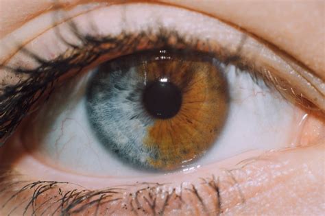 my friend s iris is split in half different colored eyes rare eye colors heterochromia eyes
