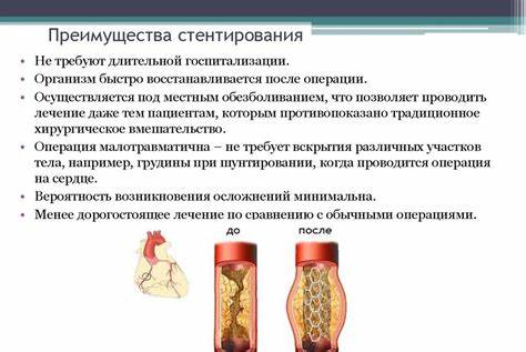 Стентирование Диета После Операции – Telegraph Картинка - Стентирование Диета После Операции – Telegraph