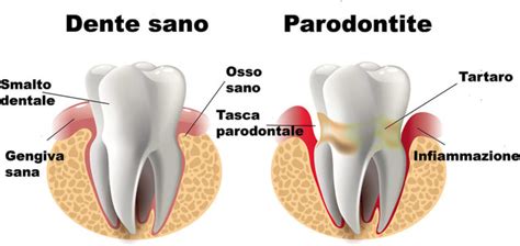 Parodontologia Croazia Fiume Orto Nova