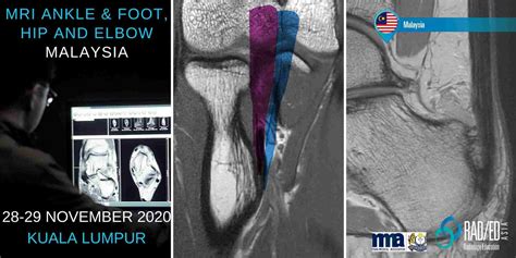 November 2020 Kuala Lumpur Malaysia Mri Ankle And Foot Hip And Elbow