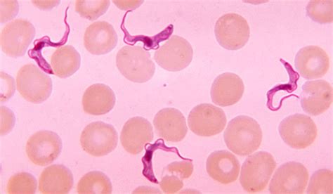 Human African Sleeping Sickness Biology Of Trypanosoma Brucei Owlcation