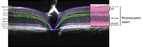 Segmented Oct B Scan With Assignment Of Retinal Layers Retina Nerve