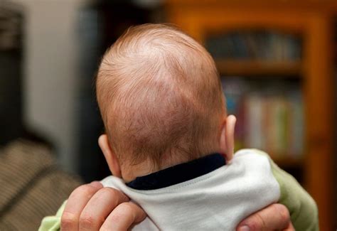 How To Cure Bump On Baby Backside Of The Head Firstcry Parenting