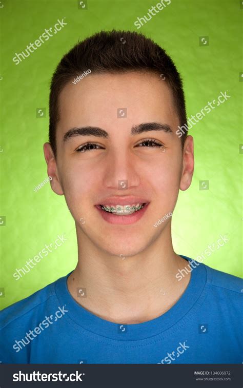 Beautiful Boy With Braces Stock Photo 134606072 Shutterstock