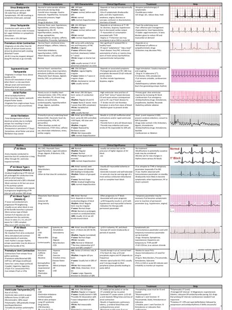 Cardiac Dysrhythmia Chart Med Surg Nur4 Cardiac Arrhythmia Heart