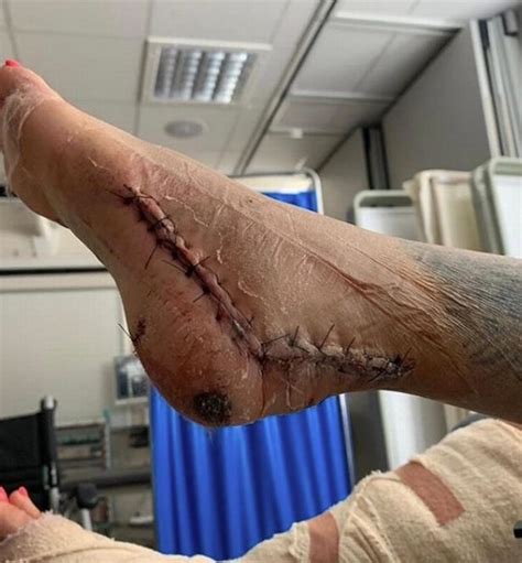 A pallet of brick pavers costs $200 to $800 per pallet on average. Katie Price shares graphic pics of feet injuries as she hits back at trolls | Movies WN