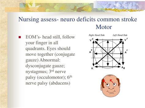 Ppt Neurosensory Stroke And Brain Tumors Powerpoint Presentation