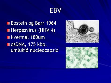 Ppt Epstein Barr Virus Diagnosis Powerpoint Presentation Free