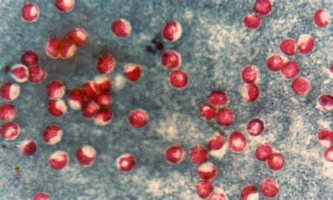Top 10 Dangerous Parasites That Infect Humans Tenzzies Top 10 Lists