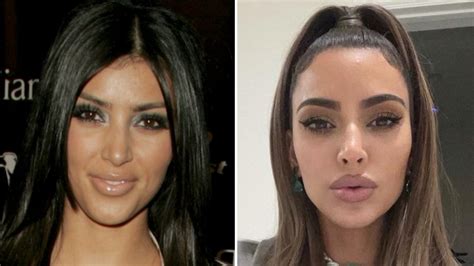 Kardashian Plastic Surgery Timeline Kim Kardashians Plastic Surgery