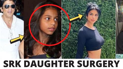Shahrukh Khan And Gauri Khan Daughter Suhana Khan Plastic Surgery Went