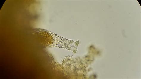 Live Microscopic Animal Rotifer Feeding Under Microscope 400x Stock
