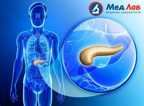 Панкреатит. Чем опасно это заболевание и как его выявить? | Медлаб Картинка - Панкреатит. Чем опасно это заболевание и как его выявить? | Медлаб