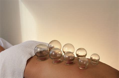 Cupping Therapy Should You Try It Blackdoctor