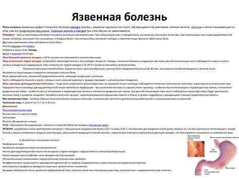 Как вызвать понос чтобы похудеть