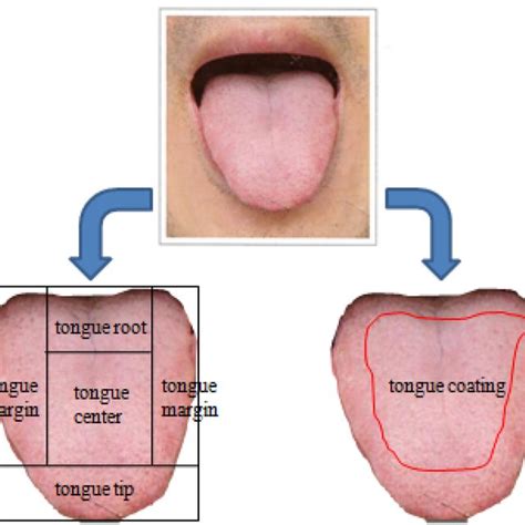 Division Of The Tongue And The Tongue Coating Download Scientific Diagram