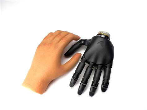 Sensational Prosthesis Prosthetic Hand With Nearly Human Capabilities
