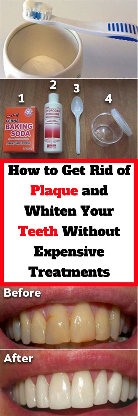 Mucoid plaque, or mucus build up, is believed to be while the subject of parasites is complex, and our understanding of parasites is also limited, the solution to getting rid of parasites from the body is. How to Get Rid of Plaque and Whiten Your Teeth Without ...