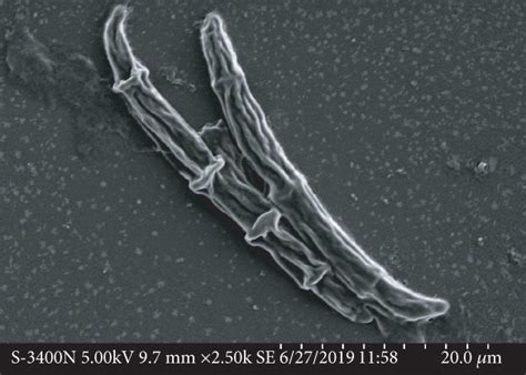 Fungal Growth And Microscopic Observation Of The Isolated Fungal Strain