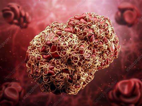 Blood Clot Illustration Stock Image C0486932 Science Photo Library