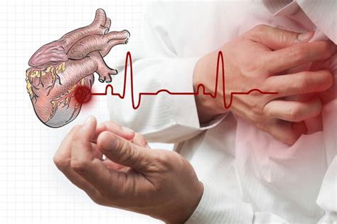 Choroba Wie Cowa Niedokrwienna Serca Diagnoza I Leczenie Jak