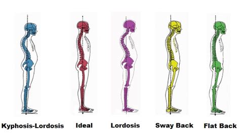 The Importance Of Having Good Posture Chiropractic Healing Center