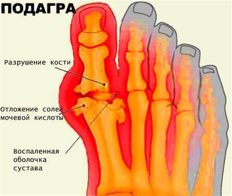 Диета 2 пальца Перелом большого пальца ноги: лечение, симптомы и первая помощь Перелом большого пальца ноги: лечение, симптомы и первая помощь Диета 2 пальца