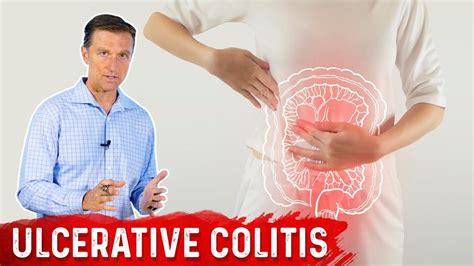 What Is Ulcerative Colitis Causes Symptoms And Treatment By Drberg