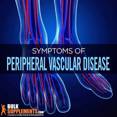 Tablo Read Peripheral Vascular Disease Symptoms Causes And Treatment By