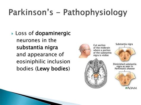 Pathophysiology Parkinsons Disease Pathology Parkinson Disease