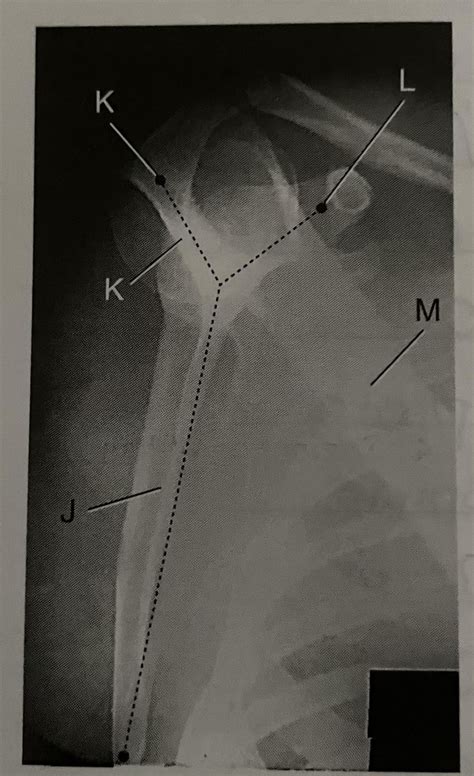 Scapular Y Shoulder Diagram Quizlet