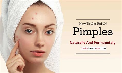 How To Remove Pimples Naturally And Permanently By Sbt