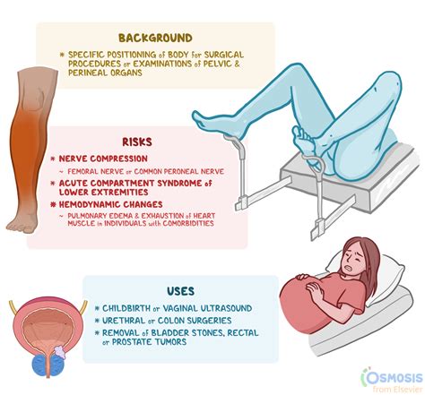 Lithotomy Position What Is It And Its Uses Osmosis