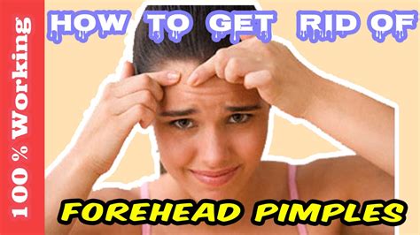 How To Get Rid Of Pimples On Forehead Overnight Fast Home Remedies