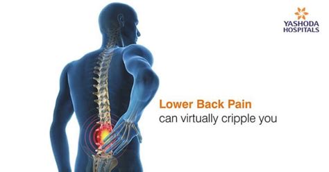 Pulled Back Muscle And Lower Back Pain Pulled Back Muscle Treatment