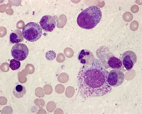 Bone Marrow Blood Cells Light Micrograph Stock Image C0463691