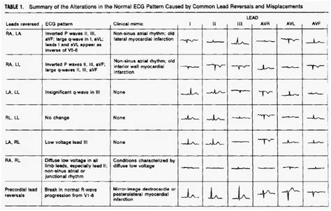 Ekg Challenge No 12 Case Conclusion Because Were Only