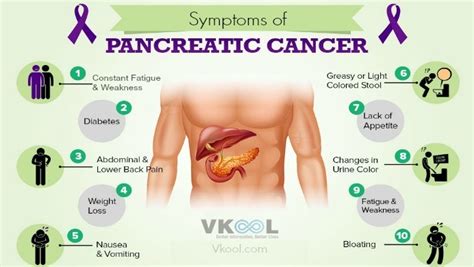 10 Early Symptoms Of Pancreatic Cancer In Humans