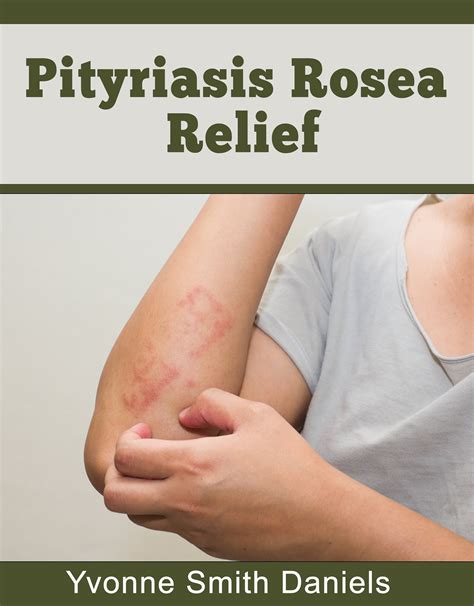 Pityriasis Rosea Relief E Book Natural Healing And Remedy Etsy Australia