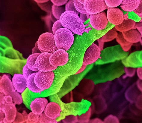 Oral Streptococcus Bacteria Photograph By Science Photo Library Pixels
