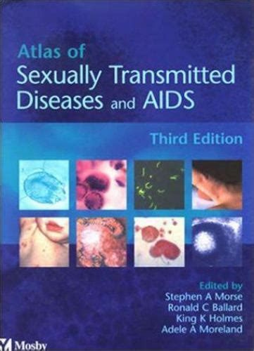 Atlas Of Sexually Transmitted Diseases And Aids By King K Holmes Stephen A Morse Ronald C