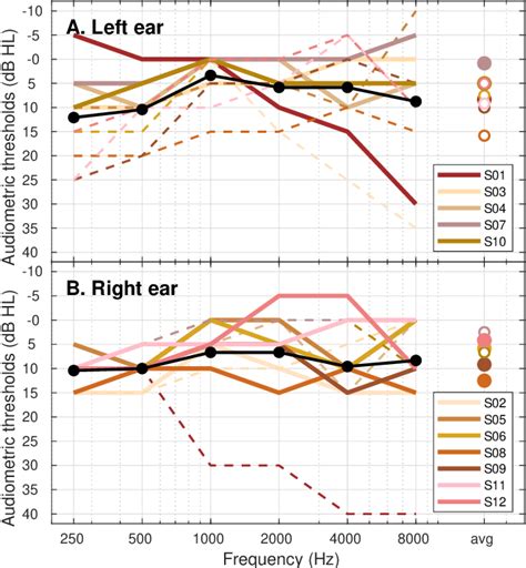 Fig A1 Audiograms For All Participants Left And Right Ear
